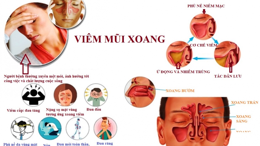 Các thói quen xấu dễ dẫn đến viêm mũi xoang